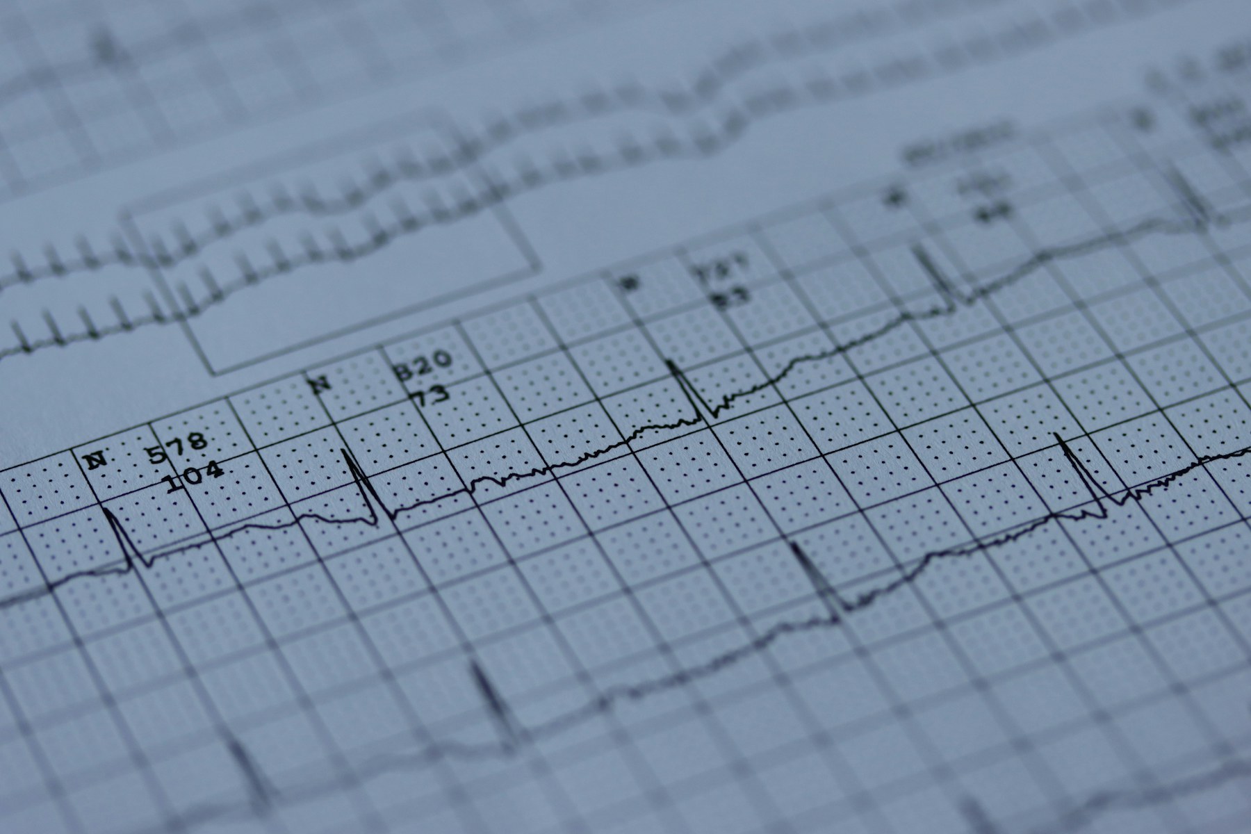Nærbilde av en EKG-kurve på millimeterpapir